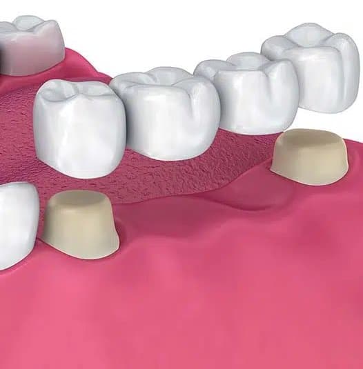 Restorative Dentistry Alhambra, CA