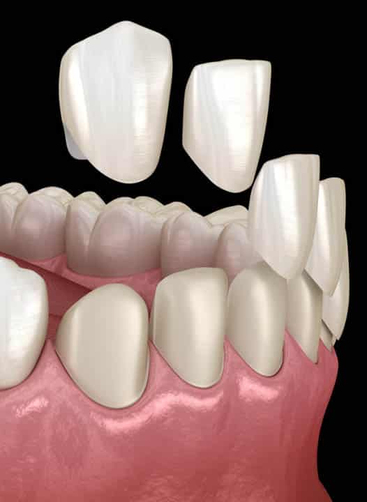 Lumineers Alhambra, CA