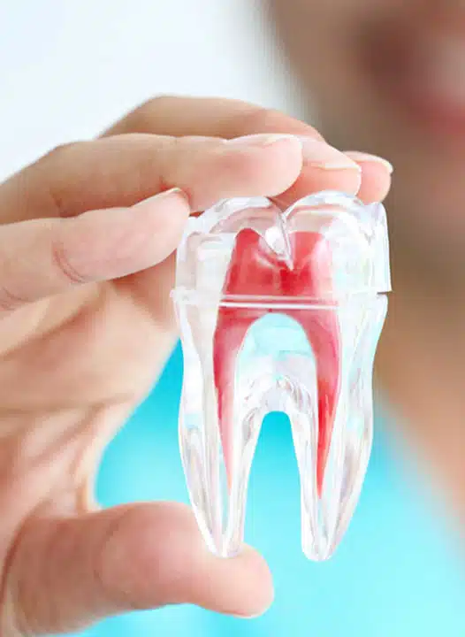 Root Canal Alhambra, CA